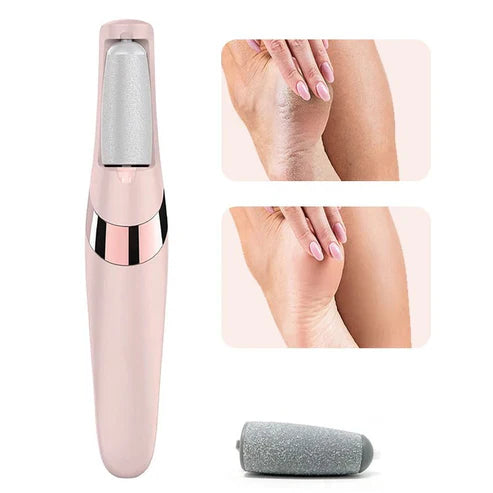 Feet Callus Remover | Good Looking Feet In Shoes